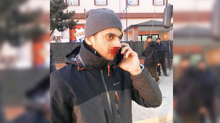 شاب مصري يتعرض لحادثة اعتداء عنصري على يد مواطن تركي في إسطنبول والسبب..