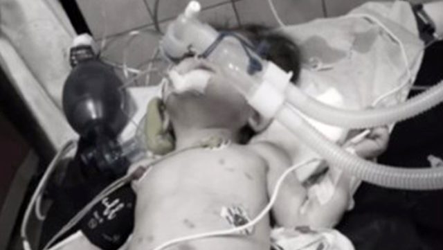 وفاة طفلة سورية في إسطنبول متأثرة بجراحها.. والجوار يدلون بشهادة صادمة