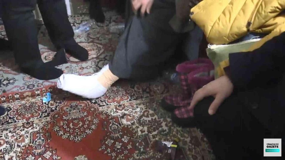 ملاحظة دقيقة للشرطة التركية تنقذ طفلة سورية من بتر قدمها